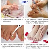 Thickening Soft With Special Bacteriostatic Liquid For Gray Nails - WOMONA.COM