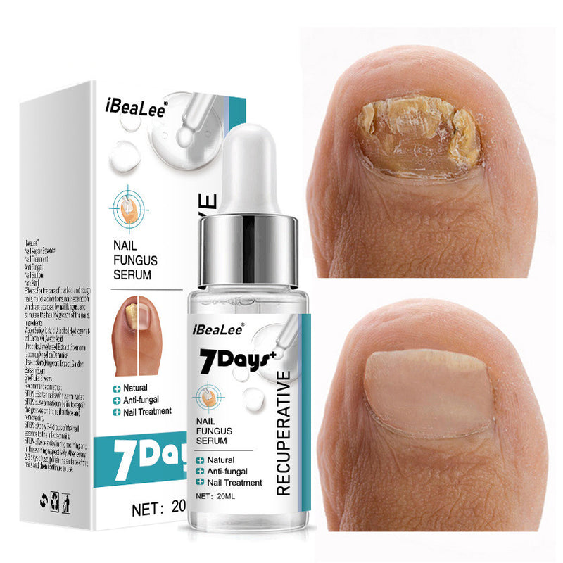 Thickening Soft With Special Bacteriostatic Liquid For Gray Nails - WOMONA.COM