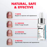 Thickening Soft With Special Bacteriostatic Liquid For Gray Nails - WOMONA.COM