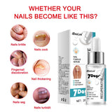 Thickening Soft With Special Bacteriostatic Liquid For Gray Nails - WOMONA.COM